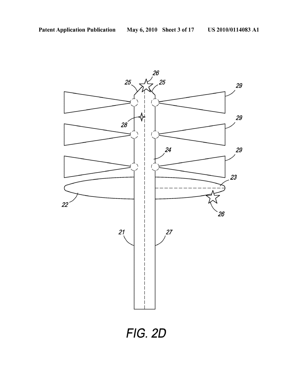 Method and Apparatus for the Ablation of Gastrointestinal Tissue - diagram, schematic, and image 04