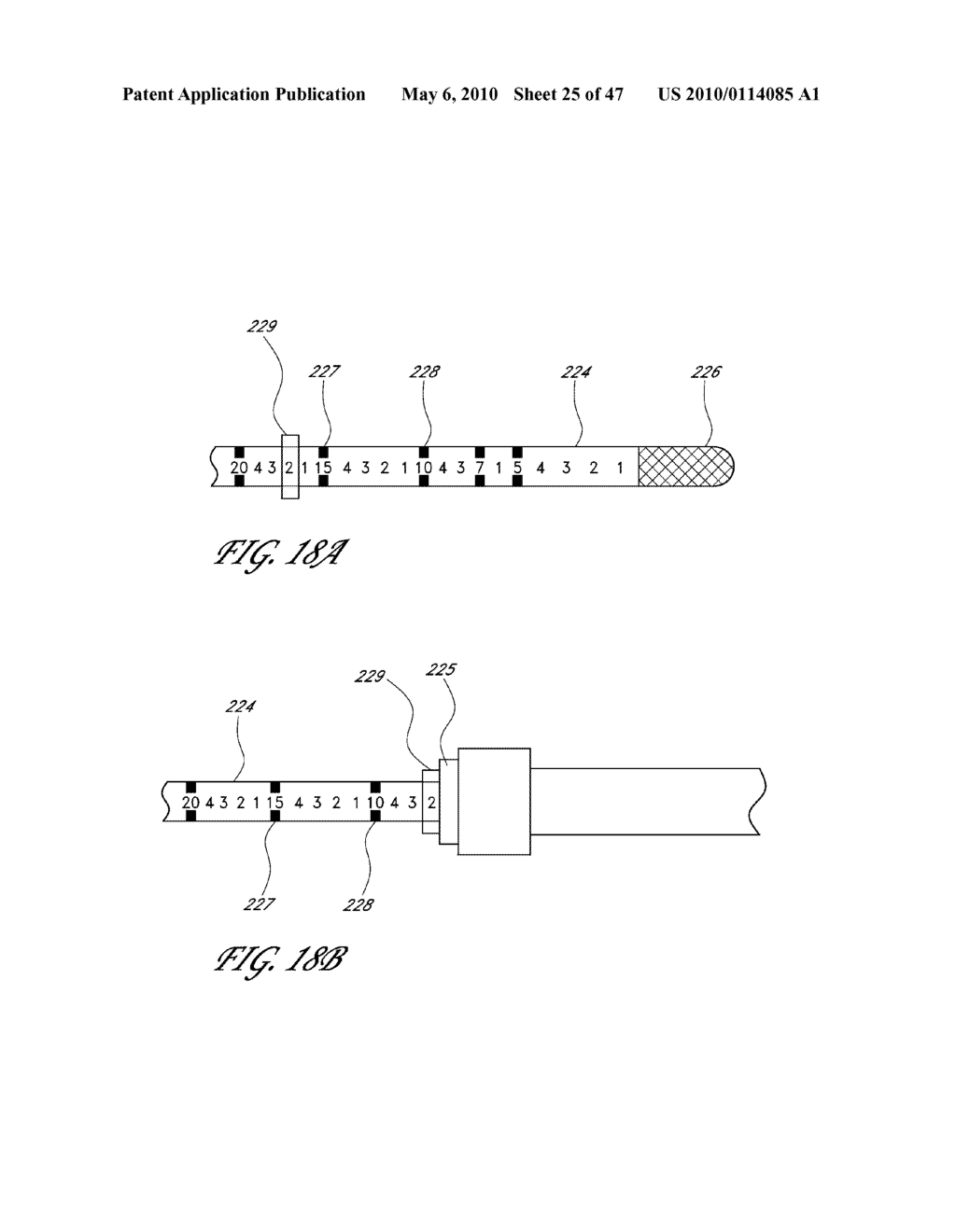 METHODS FOR TREATING A HOLLOW ANATOMICAL STRUCTURE - diagram, schematic, and image 26