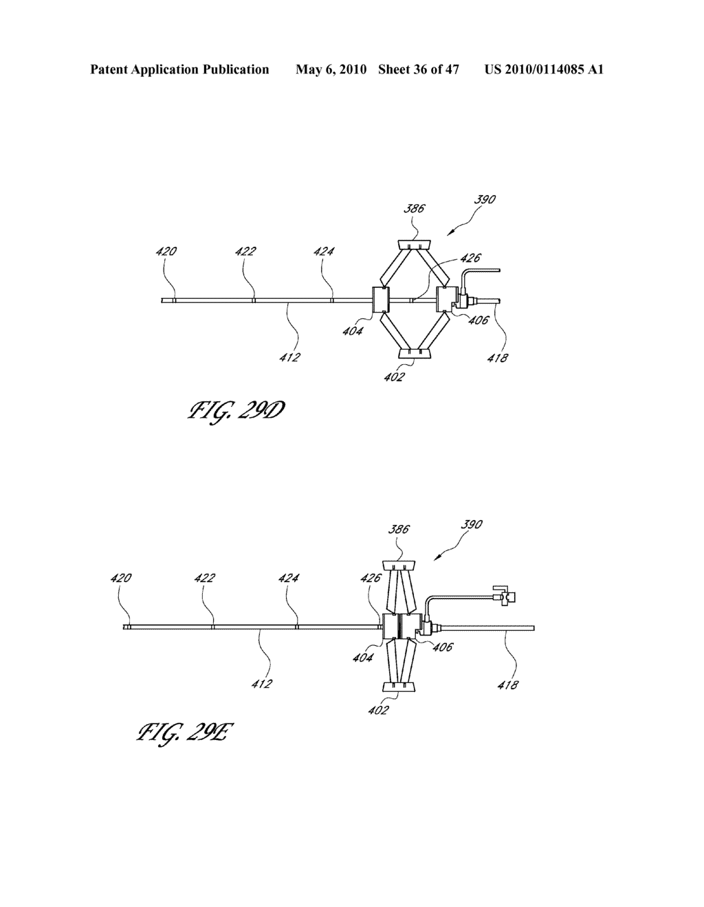 METHODS FOR TREATING A HOLLOW ANATOMICAL STRUCTURE - diagram, schematic, and image 37