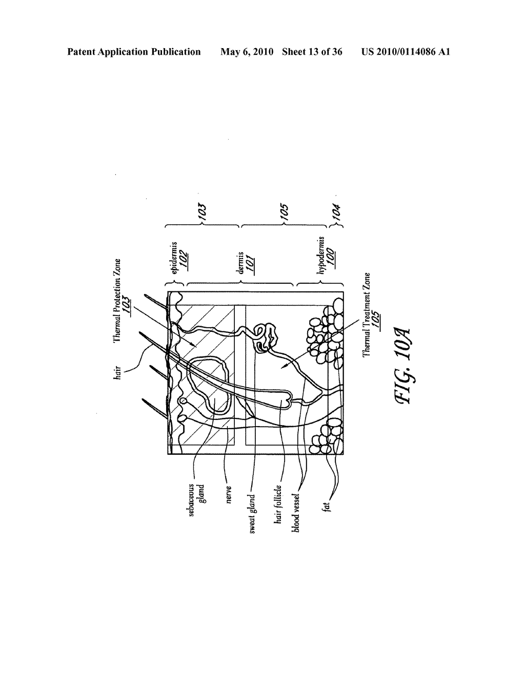 METHODS, DEVICES, AND SYSTEMS FOR NON-INVASIVE DELIVERY OF MICROWAVE THERAPY - diagram, schematic, and image 14