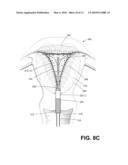 ENDOMETRIAL ABLATION DEVICES AND SYSTEMS diagram and image