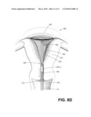 ENDOMETRIAL ABLATION DEVICES AND SYSTEMS diagram and image