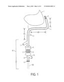 Epicardial Ablation Catheter and Method of Use diagram and image