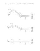 Epicardial Ablation Catheter and Method of Use diagram and image