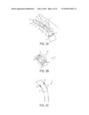 Epicardial Ablation Catheter and Method of Use diagram and image