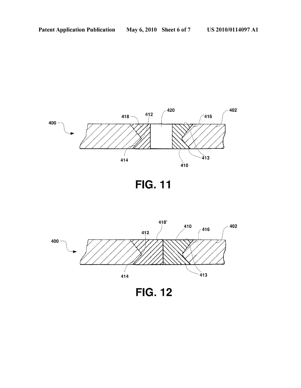 Implant Devices Constructed with Metallic and Polymeric Components - diagram, schematic, and image 07