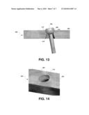 Implant Devices Constructed with Metallic and Polymeric Components diagram and image