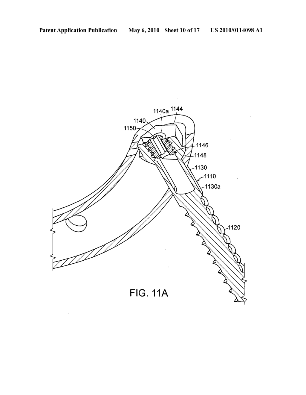 DEVICES AND METHODS FOR STABILIZING A SPINAL REGION - diagram, schematic, and image 11