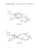 METHOD OF RESECTING A FEMORAL HEAD FOR IMPLANTATION OF A FEMORAL NECK FIXATION PROSTHESIS diagram and image