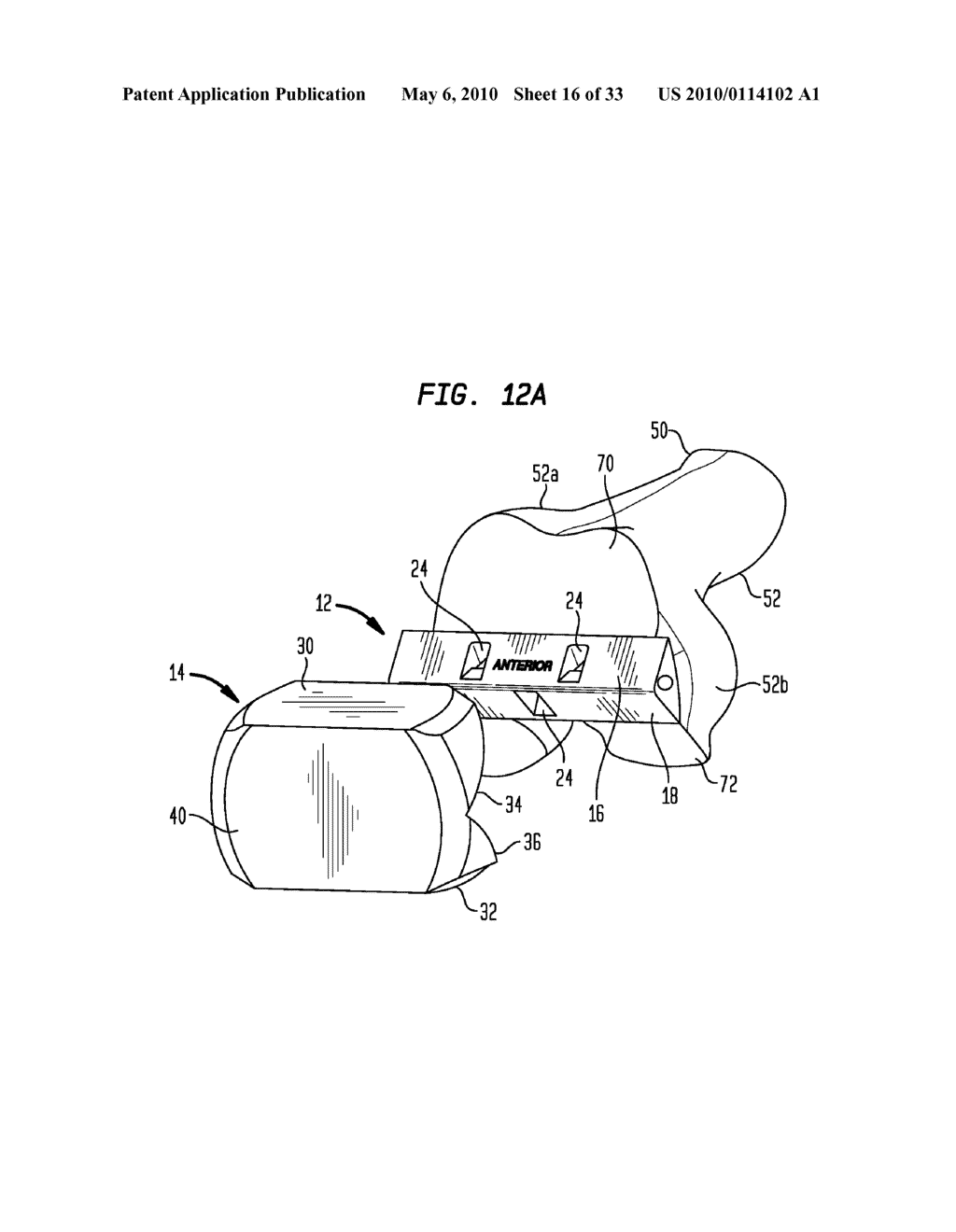 FEMORAL CUTTING BLOCK - diagram, schematic, and image 17