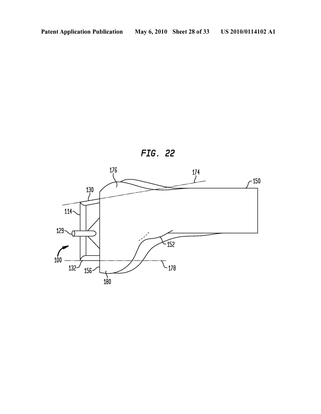 FEMORAL CUTTING BLOCK - diagram, schematic, and image 29