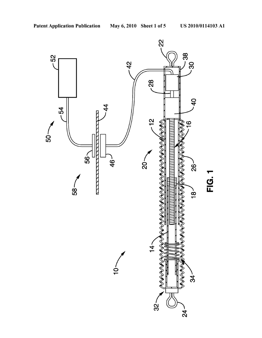 APPARATUS AND METHODS FOR ALTERATION OF ANATOMICAL FEATURES - diagram, schematic, and image 02