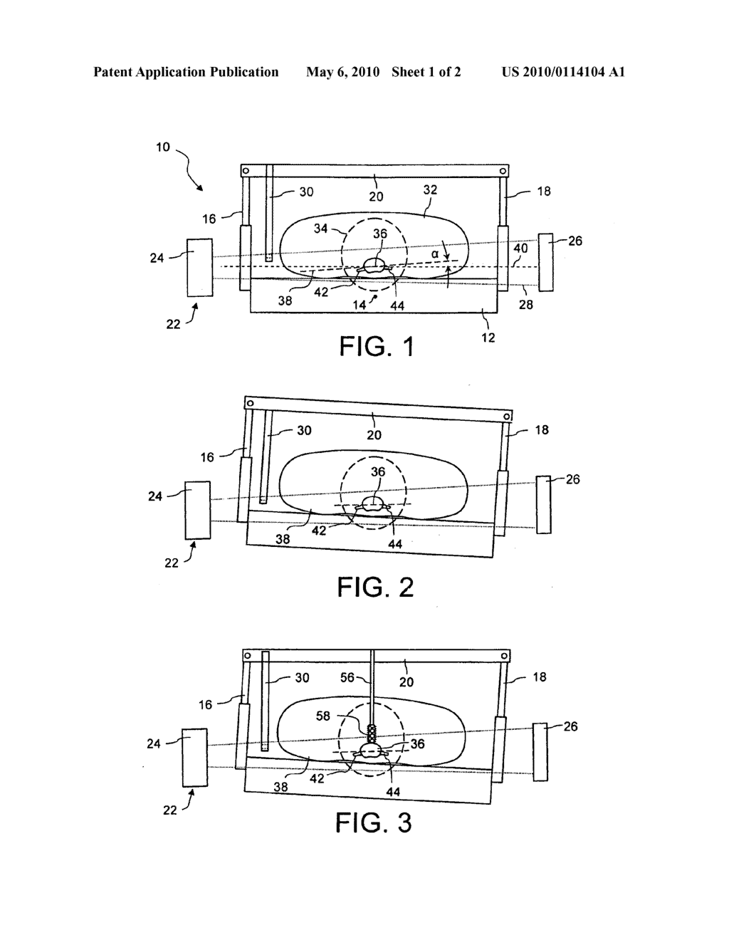 SYSTEM FOR ALIGNING A METERIAL-ABRADING TOOL RELATIVE TO AN INTERVERTEBRAL-DISC COMPARTMENT - diagram, schematic, and image 02
