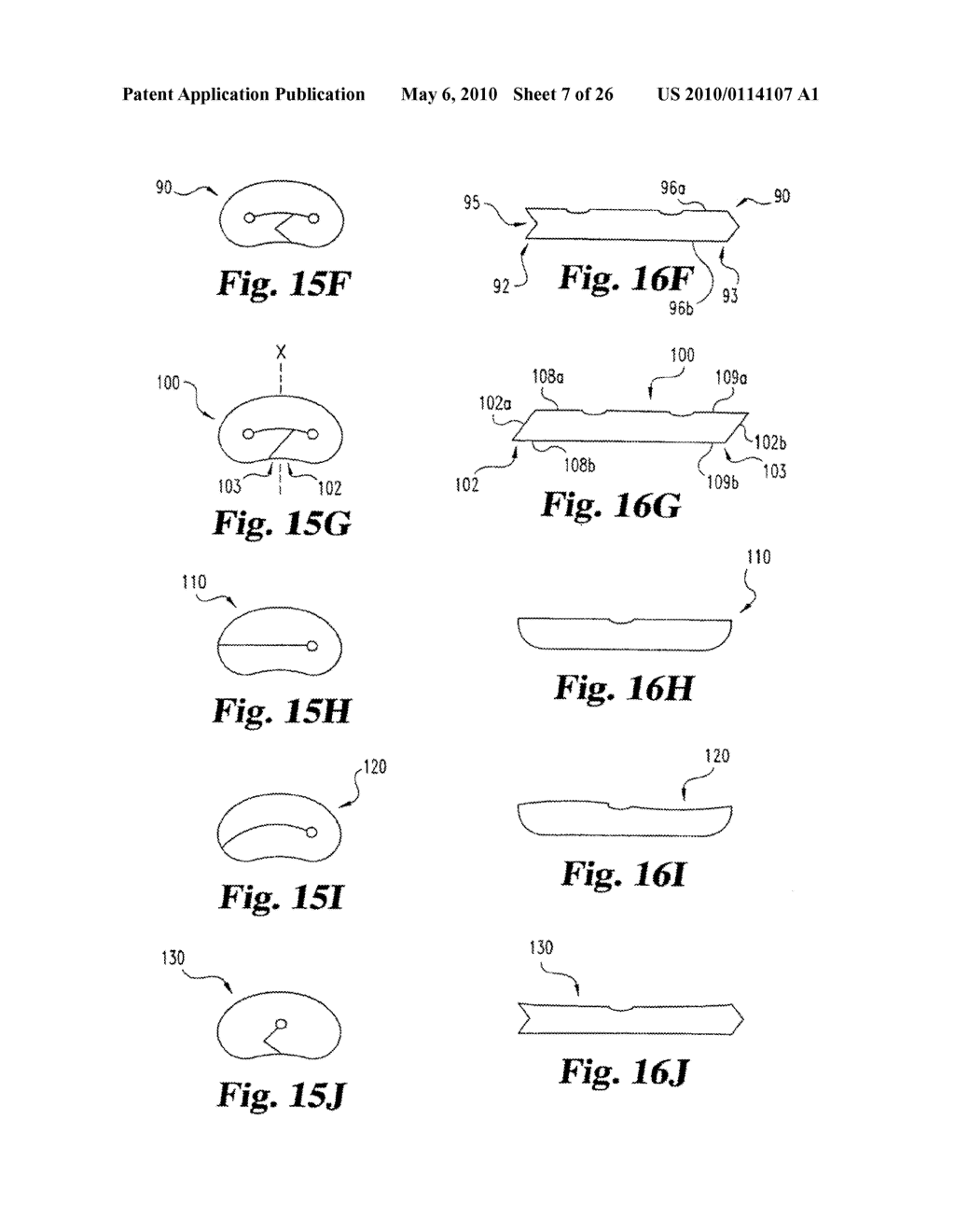 Intervertebral Disc Nucleus Implants and Methods - diagram, schematic, and image 08