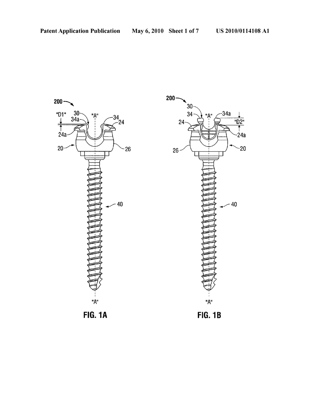 MULTIPLANAR TAPER LOCK SCREW AND LOCK INDICATOR GAUGE - diagram, schematic, and image 02