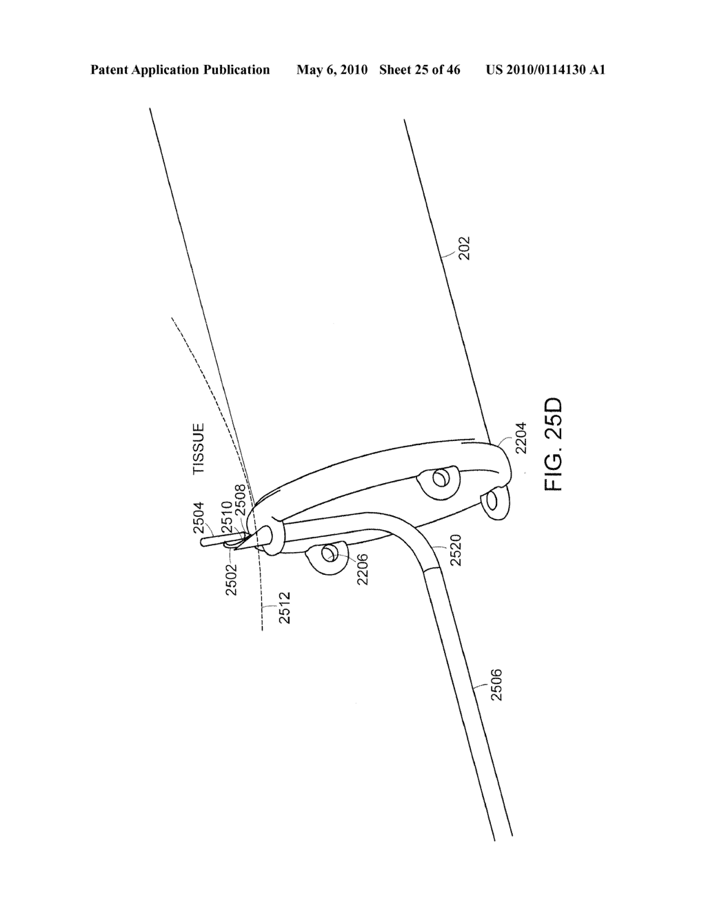 INTESTINAL SLEEVE - diagram, schematic, and image 26