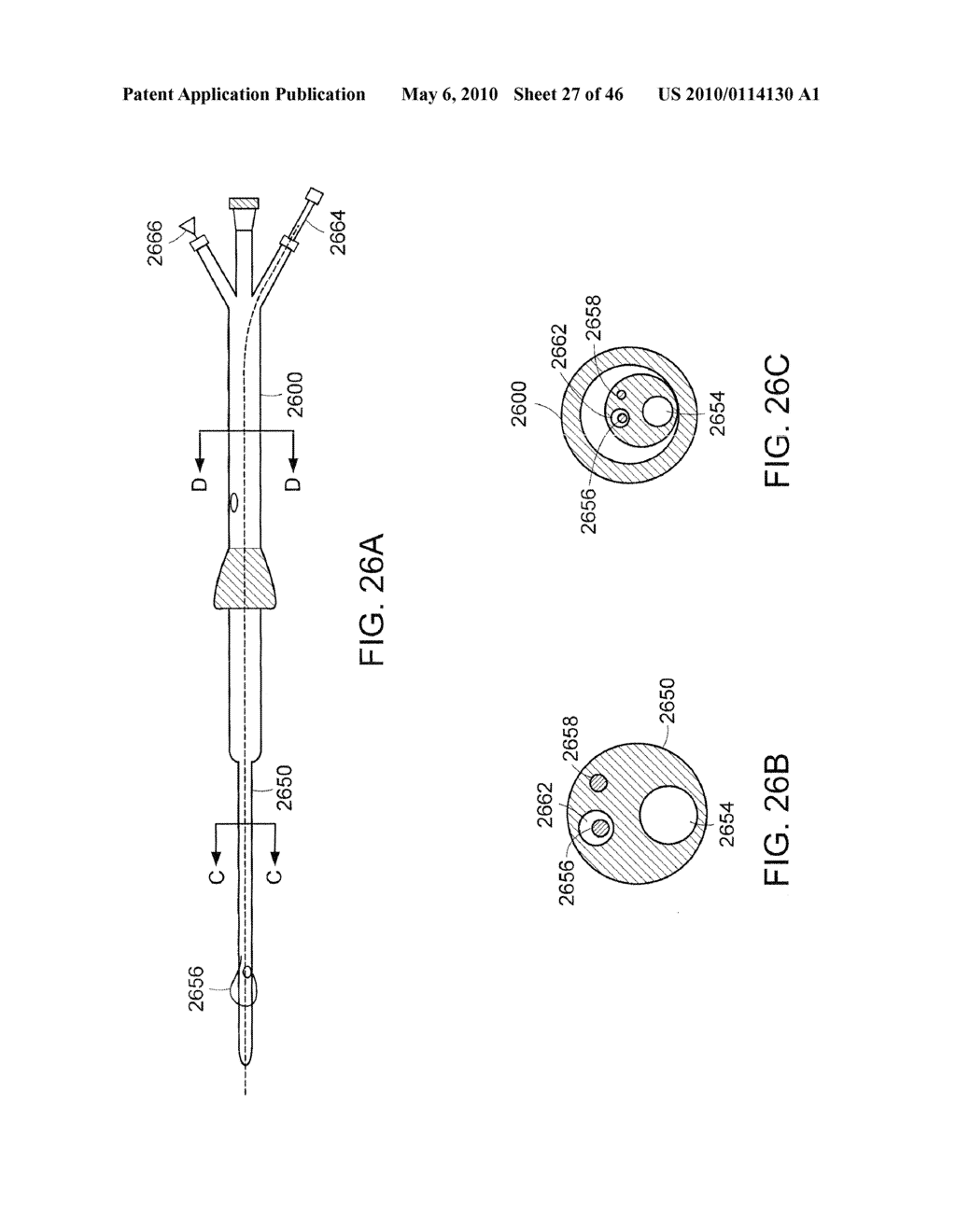 INTESTINAL SLEEVE - diagram, schematic, and image 28