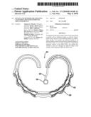 DEVICES AND METHODS FOR ADJUSTING A SATIATION AND SATIETY-INDUCING IMPLANTED DEVICE diagram and image