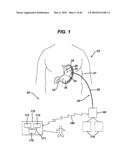 DEVICES AND METHODS FOR ADJUSTING A SATIATION AND SATIETY-INDUCING IMPLANTED DEVICE diagram and image