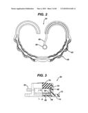 DEVICES AND METHODS FOR ADJUSTING A SATIATION AND SATIETY-INDUCING IMPLANTED DEVICE diagram and image