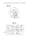 DEVICES AND METHODS FOR ADJUSTING A SATIATION AND SATIETY-INDUCING IMPLANTED DEVICE diagram and image