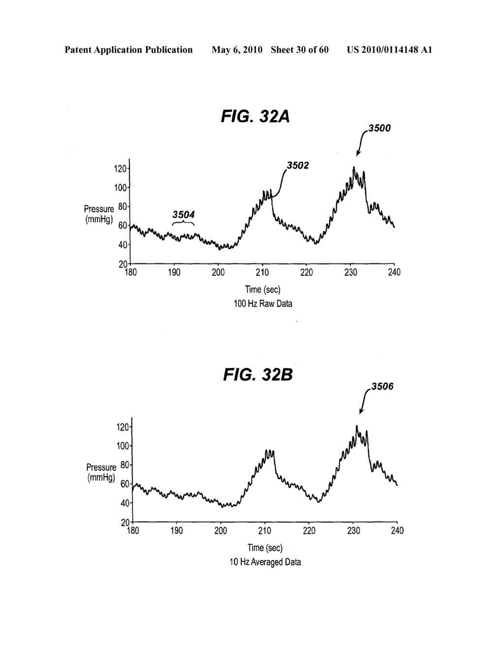 DEVICES AND METHODS FOR ADJUSTING A SATIATION AND SATIETY-INDUCING IMPLANTED DEVICE - diagram, schematic, and image 31