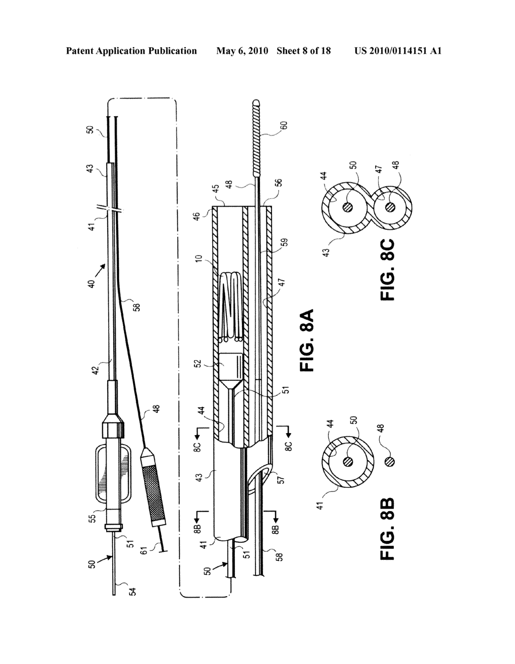 METHODS AND DEVICES FOR DEPLOYMENT INTO A LUMEN - diagram, schematic, and image 09