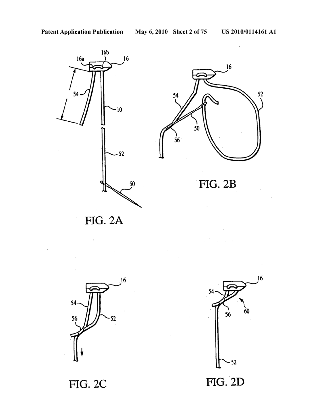 Apparatus for Tissue Repair - diagram, schematic, and image 03