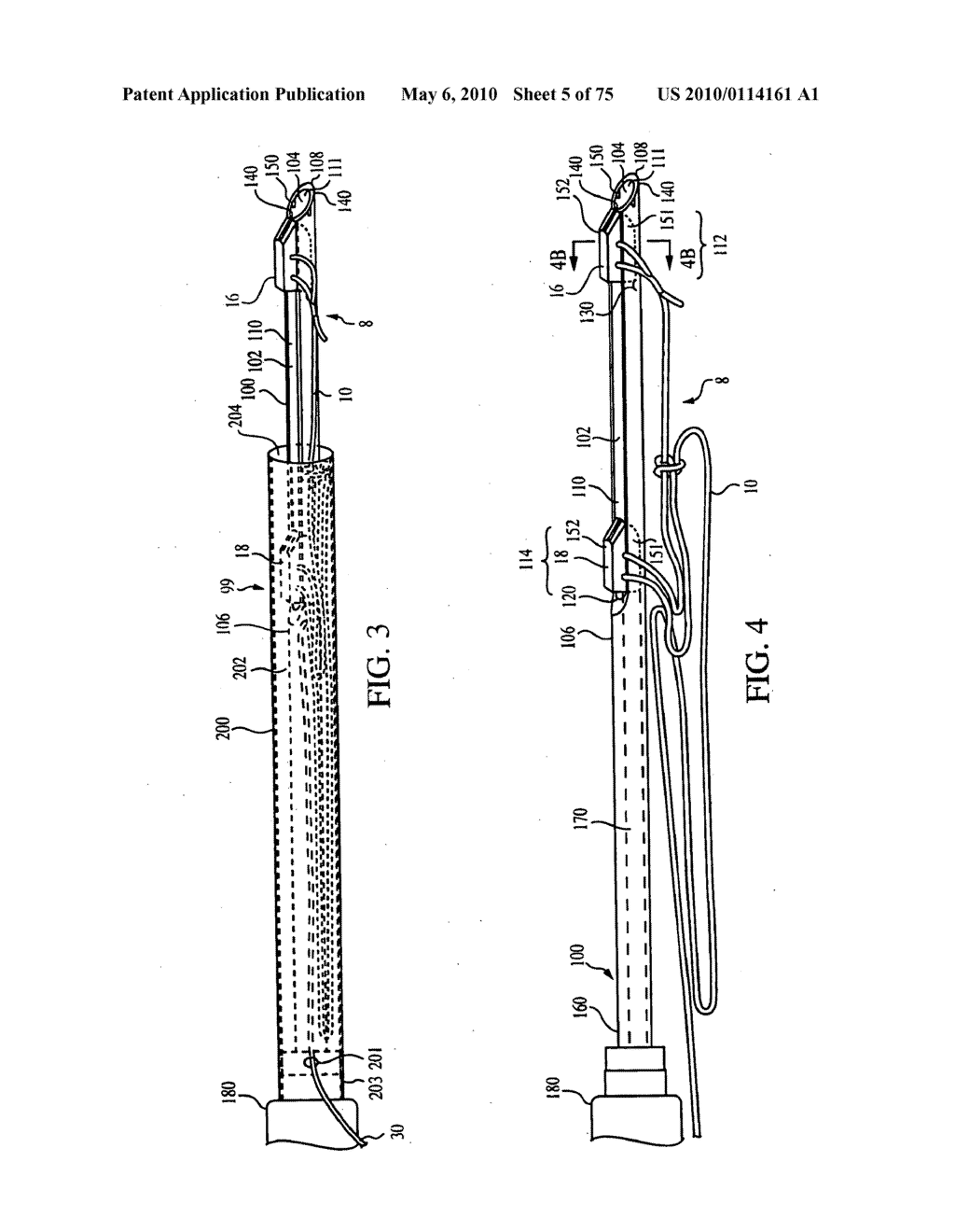 Apparatus for Tissue Repair - diagram, schematic, and image 06