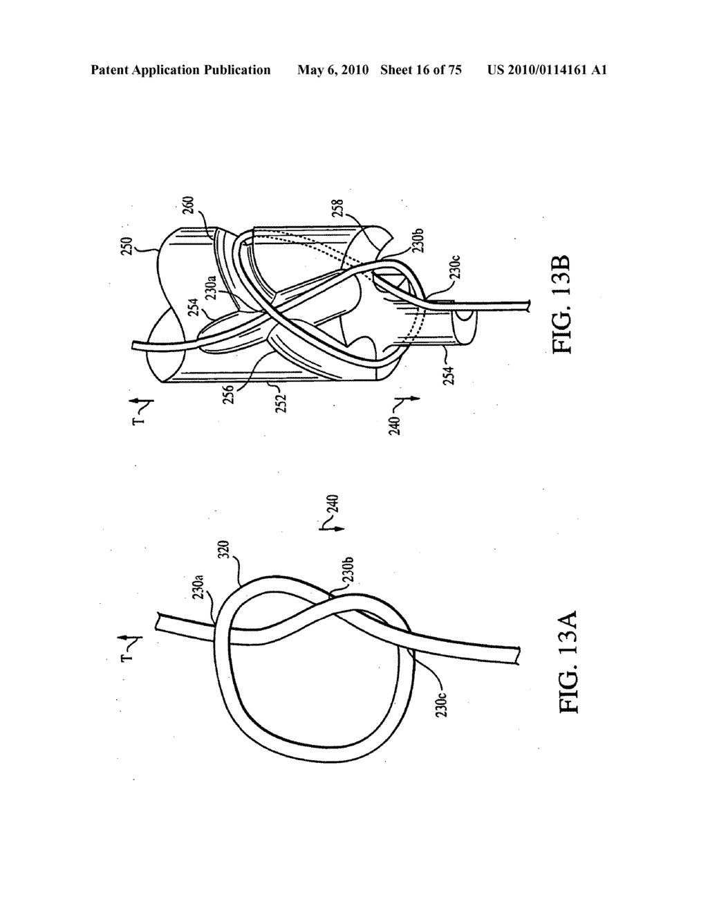 Apparatus for Tissue Repair - diagram, schematic, and image 17