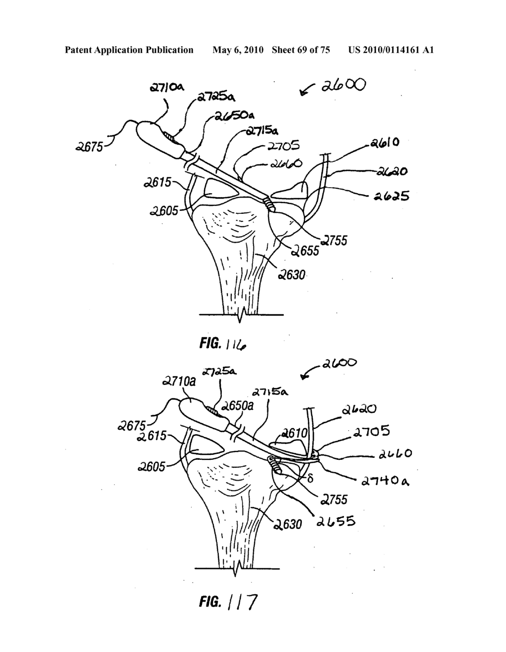 Apparatus for Tissue Repair - diagram, schematic, and image 70