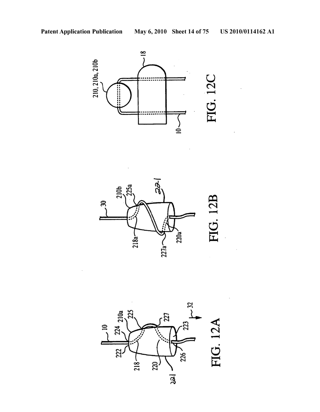 Methods for Tissue Repair - diagram, schematic, and image 15