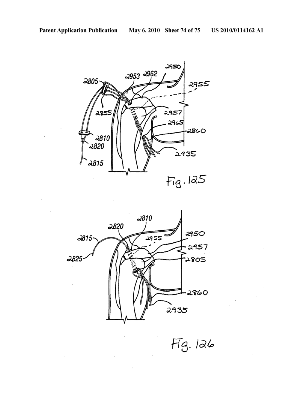 Methods for Tissue Repair - diagram, schematic, and image 75