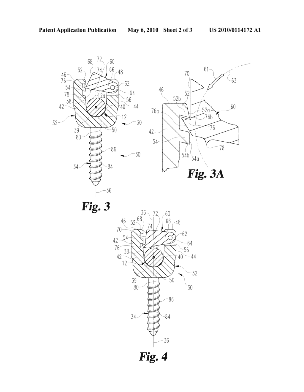 ANCHOR ASSEMBLIES FOR SECURING CONNECTING ELEMENTS ALONG A SPINAL COLUMN - diagram, schematic, and image 03