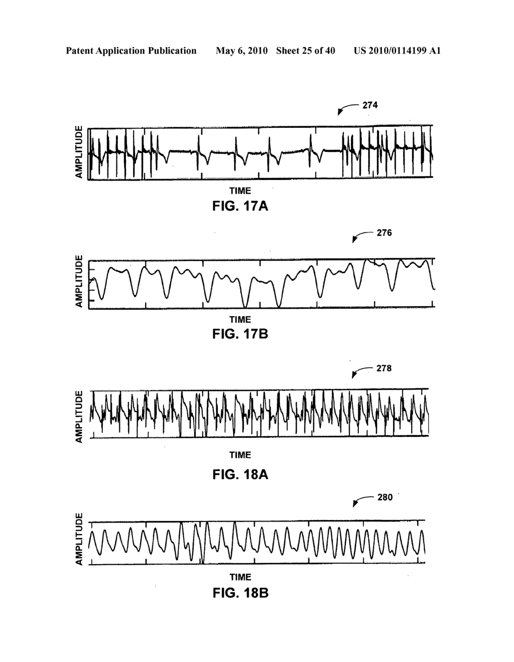 IMPLANTABLE MEDICAL DEVICE CROSSTALK EVALUATION AND MITIGATION - diagram, schematic, and image 26