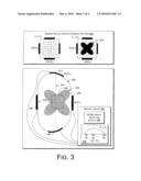 INTERFERENTIAL CARDIAC PRECONDITIONING AND DEPOLARIZATION diagram and image