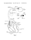 HYBRID BATTERY SYSTEM WITH BIOELECTRIC CELL FOR IMPLANTABLE CARDIAC THERAPY DEVICE diagram and image