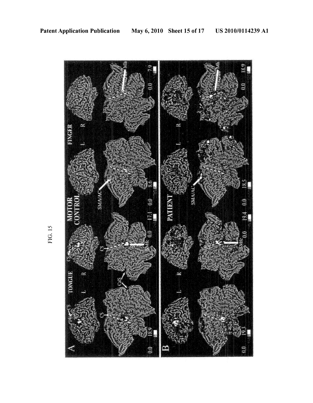 METHODS FOR TREATING CENTRAL NERVOUS SYSTEM DAMAGE - diagram, schematic, and image 16