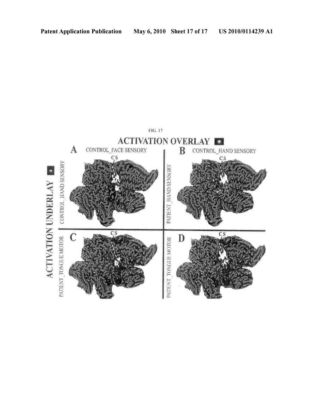 METHODS FOR TREATING CENTRAL NERVOUS SYSTEM DAMAGE - diagram, schematic, and image 18