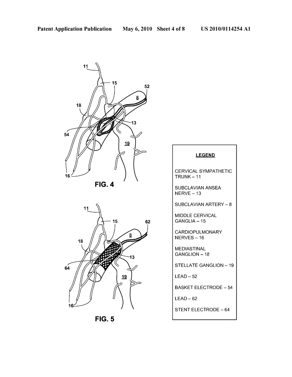 SUBCLAVIAN ANSAE STIMULATION - diagram, schematic, and image 05