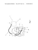 IMPLANTABLE LINE diagram and image