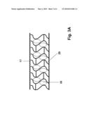 IMPLANTABLE LINE diagram and image