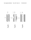 IMPLANTABLE LINE diagram and image