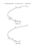 LEAD ASSEMBLY WITH POROUS POLYETHYLENE COVER diagram and image