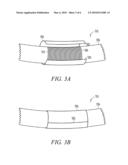 LEAD ASSEMBLY WITH POROUS POLYETHYLENE COVER diagram and image