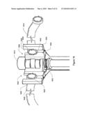 Multibranch Vessel Extender diagram and image