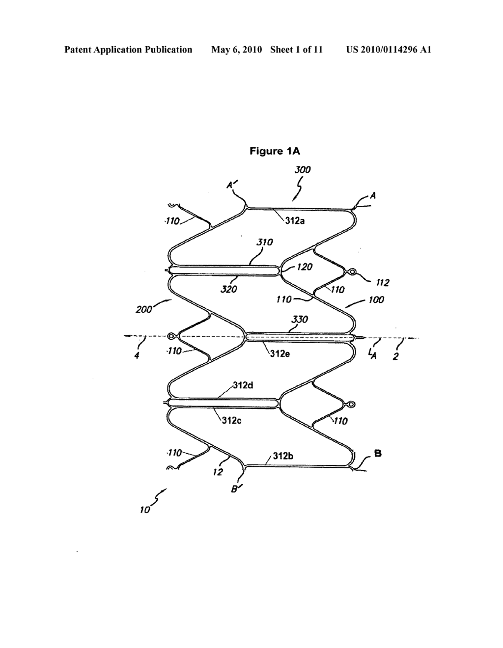 INTRALUMENALLY-IMPLANTABLE FRAMES - diagram, schematic, and image 02