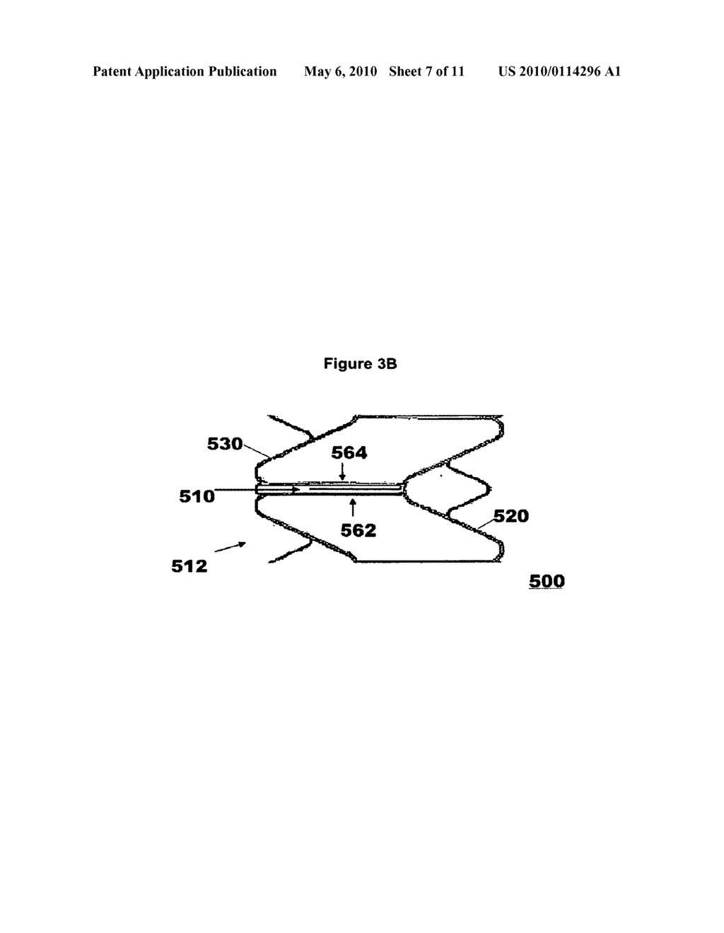 INTRALUMENALLY-IMPLANTABLE FRAMES - diagram, schematic, and image 08