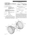 FLOW REDUCING IMPLANT diagram and image