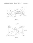 FLOW REDUCING IMPLANT diagram and image